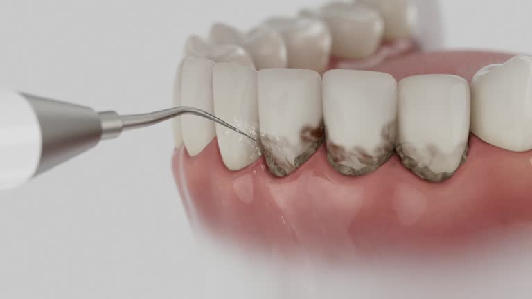 Trusted Invisalign Clear Aligners service in White Pigeon, MI - Dentist Open Now